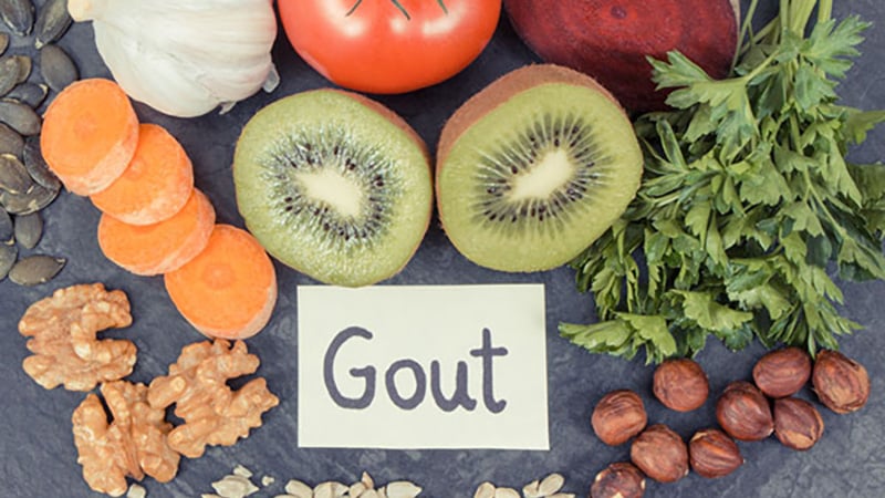 A variety of fresh foods, including garlic, tomatoes, kiwi, and nuts, arranged around a card labeled “Gout,” symbolizing dietary management for gout arthritis.