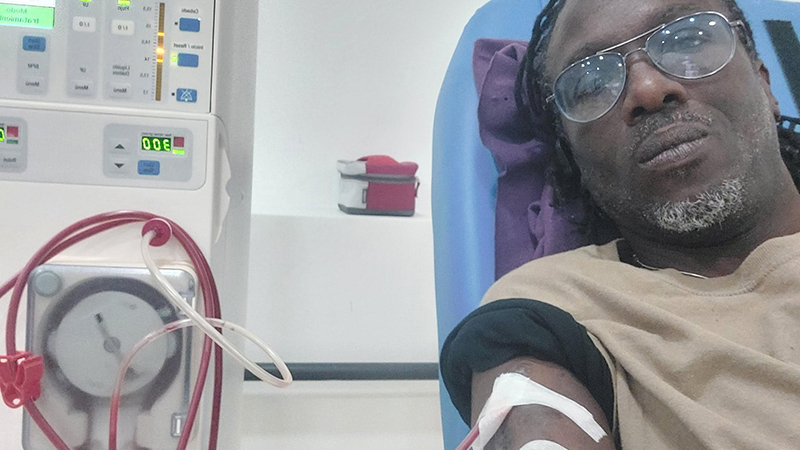A man undergoing dialysis, connected to a dialysis machine, with a serious expression, symbolizing resilience and determination in the fight against kidney disease.