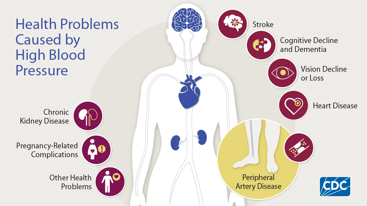 Understanding and Diagnosing High Blood Pressure
