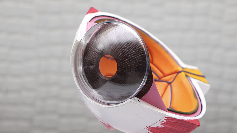 What Is Glaucoma? Causes, Symptoms, and Eye Treatments
