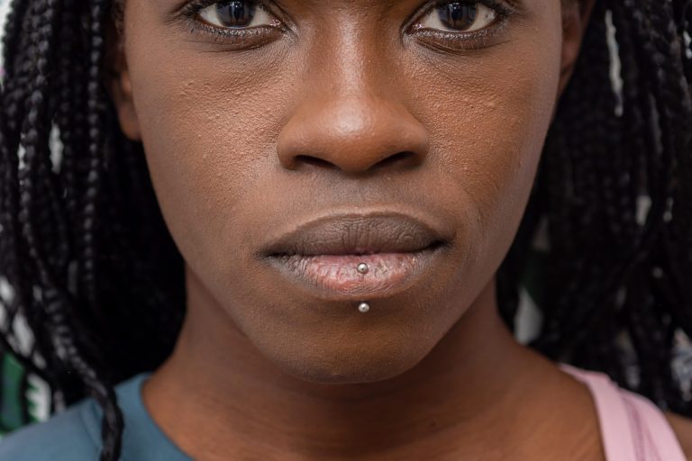 Hope Johnson Wins the Battle Over Mental Illness