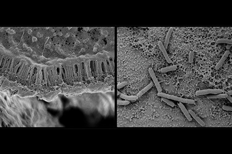 Microbiome Bacteria Adapt To Humans Through Transmission: Study