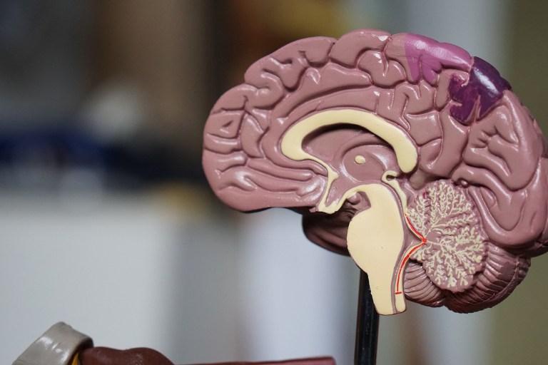 Genome-Editing Strategy Developed For Potential Alzheimer’s Disease Therapy: Study