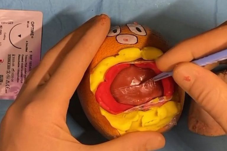 VIDEO: A-Pine-dectomy Anyone? Trainee Doc’s Surgery On Fruit And Vegetables