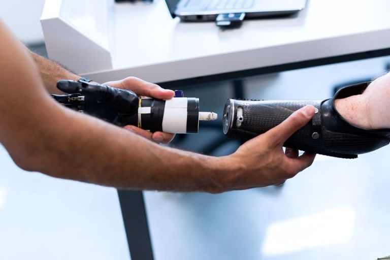 Magnets Could Offer Better Control Of Prosthetic Limbs: Study