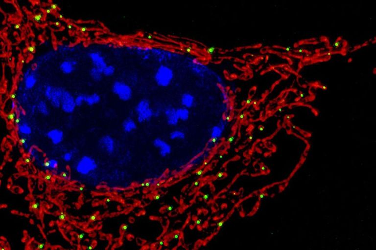 How A Parkinson’s Disease-linked Protein Attacks Mitochondria