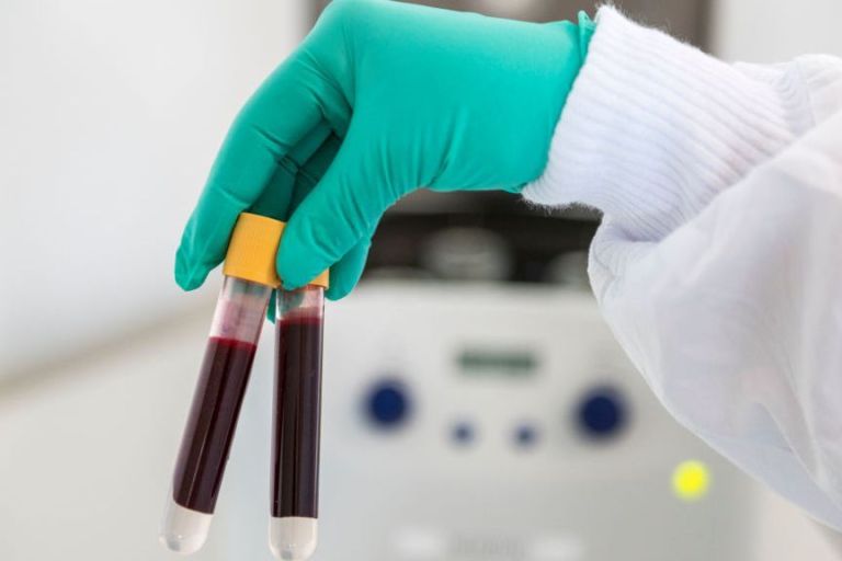 ‘Long COVID’ May Be Caused By Abnormal Blood Clotting