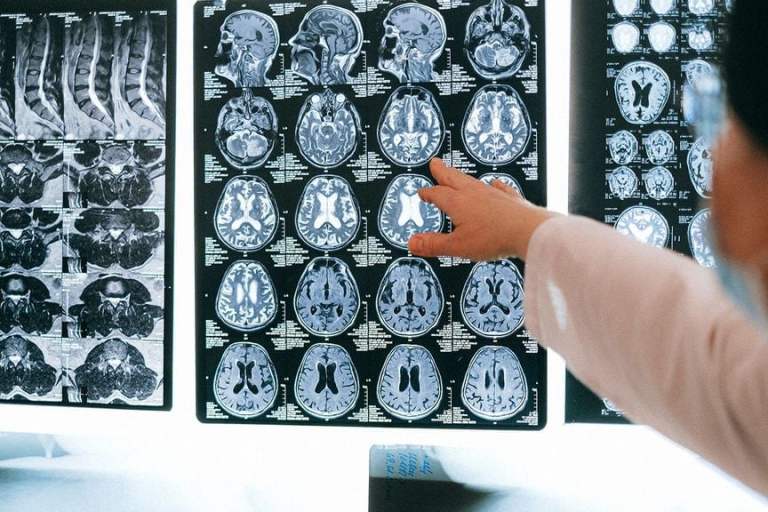 Scientists Discover Potential To Reverse Aging In Brain