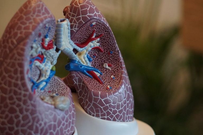 Lung Changes Can Be Early Warning Of Breast Cancer Spread
