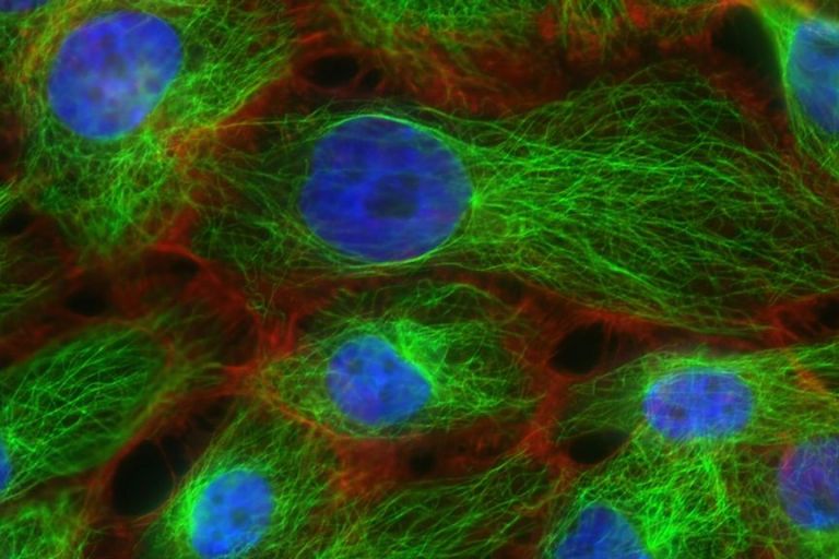 Good Vibes; How Docs Are Destroying Cancer Cells With High Intensity Ultrasound 