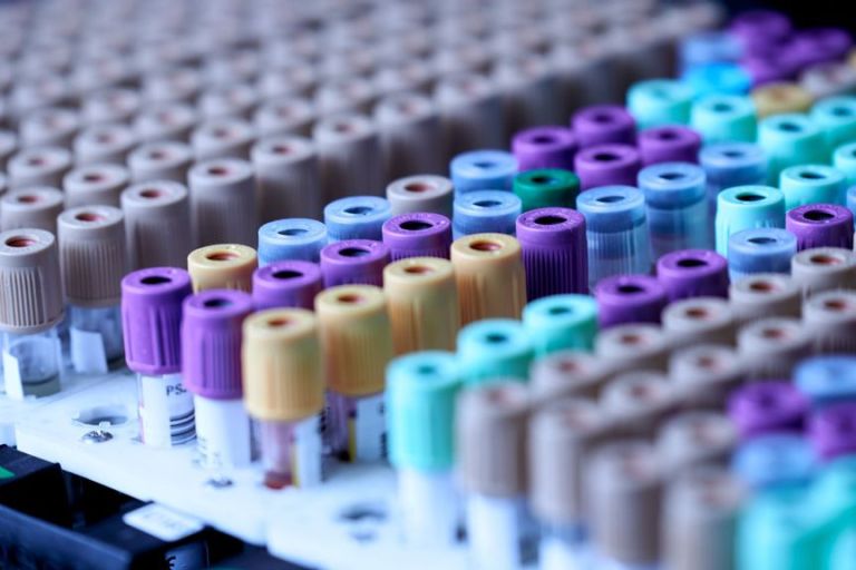 A Blood Test That Can Identify Recurrent Cancer