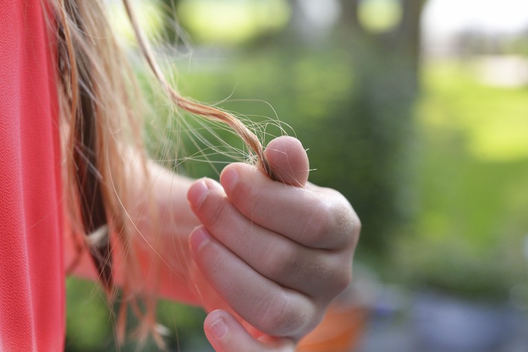 Hair Raising: The Bald Truth About COVID Hair Loss