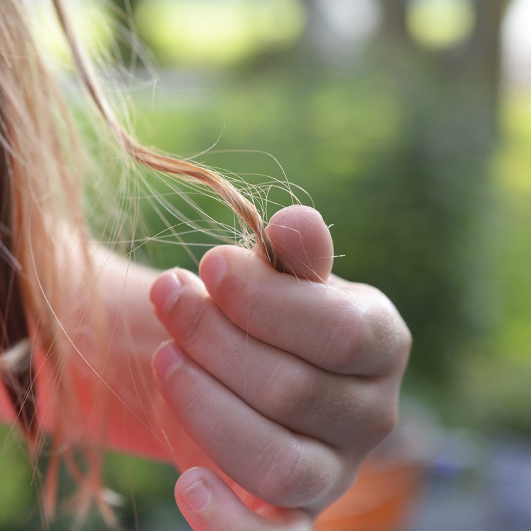 Hair Raising: The Bald Truth About COVID Hair Loss