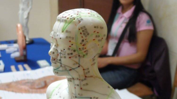 Does Acupuncture Have Any Health Benefits?