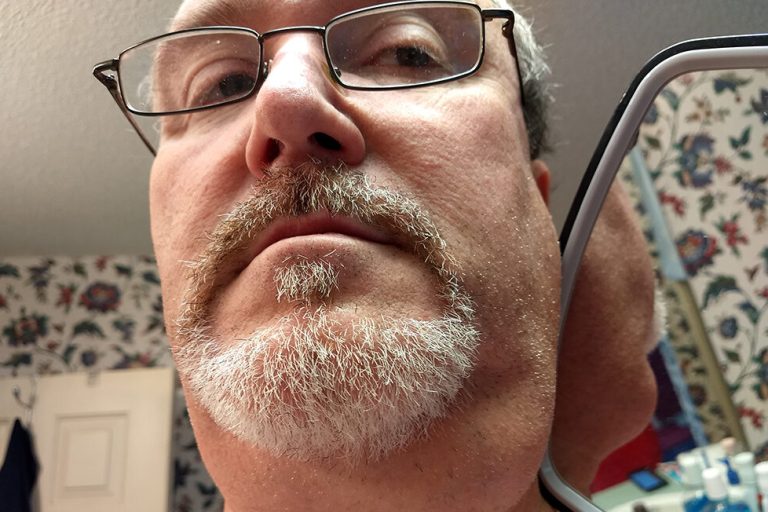 South Carolina Man Says Oral Cancer Upended — Then Saved — His Life