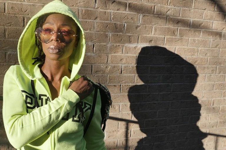 A Babysitter Scalded Her With Boiling Water — Now She Jokes About the Pain