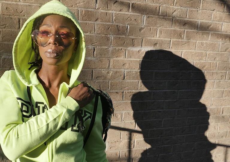 A Babysitter Scalded Her With Boiling Water — Now She Jokes About the Pain