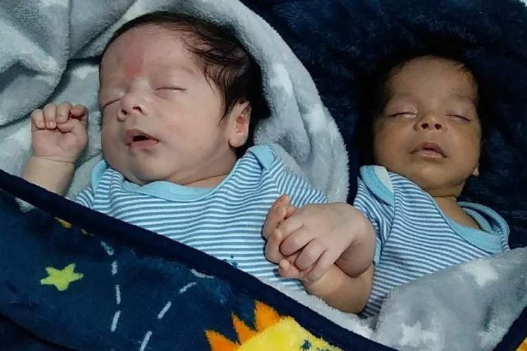 Twins With Different Skin Tone Born In Mexico