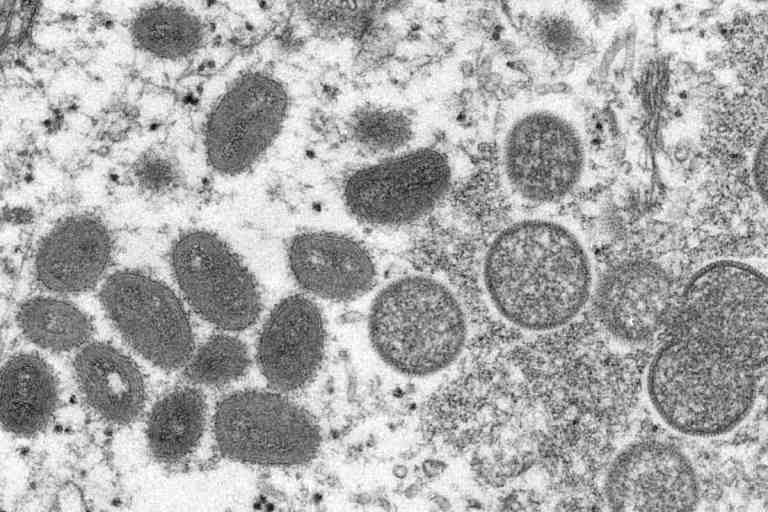 Emergence of More Viral Infection During the Covid-19 Pandemic