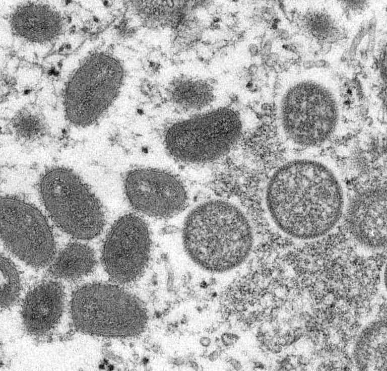 Emergence of More Viral Infection During the Covid-19 Pandemic