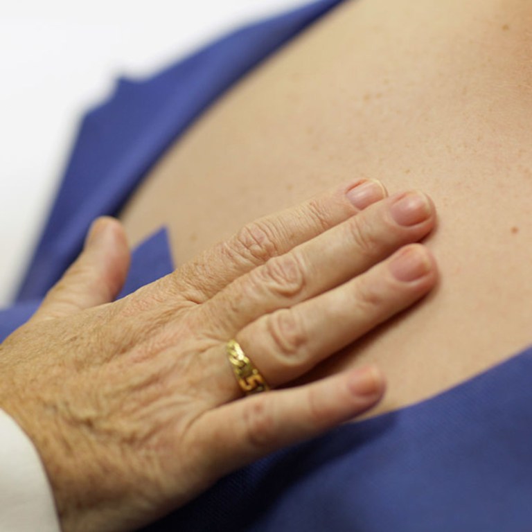 New Treatments For The Most Severe Form Of Skin Cancer Could Be Made Possible