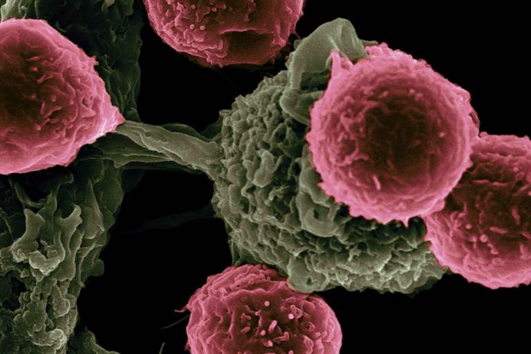 <strong>Understanding Cell Migration and Movement has Helped to Understand DNA Shedding from Various Cancers</strong>