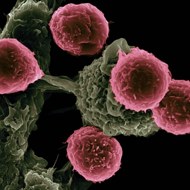 <strong>Understanding Cell Migration and Movement has Helped to Understand DNA Shedding from Various Cancers</strong>