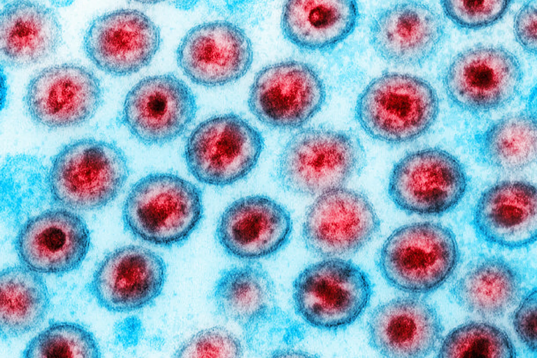 Scientists Discover New HIV Strain In 20 Years