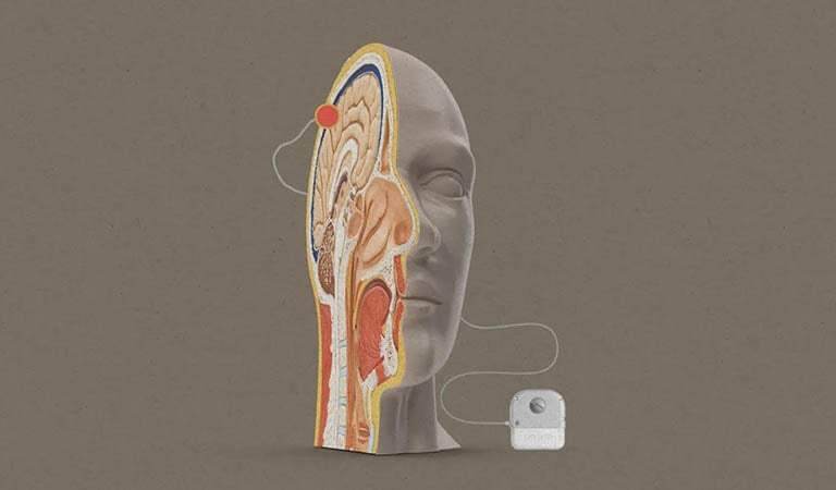 Breaking Barriers: The Exciting Advancements of Neurotechnology