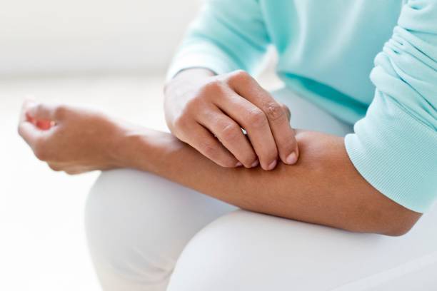 Shingles Symptoms, Causes, and Treatments