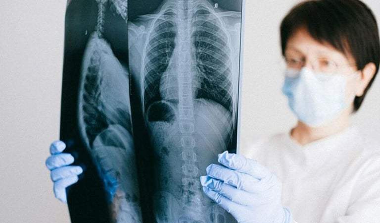 Novel Antibody May Be Key To Better Lung Cancer Treatment