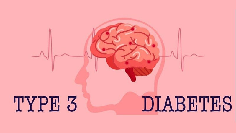 Type 3 Diabetes 1