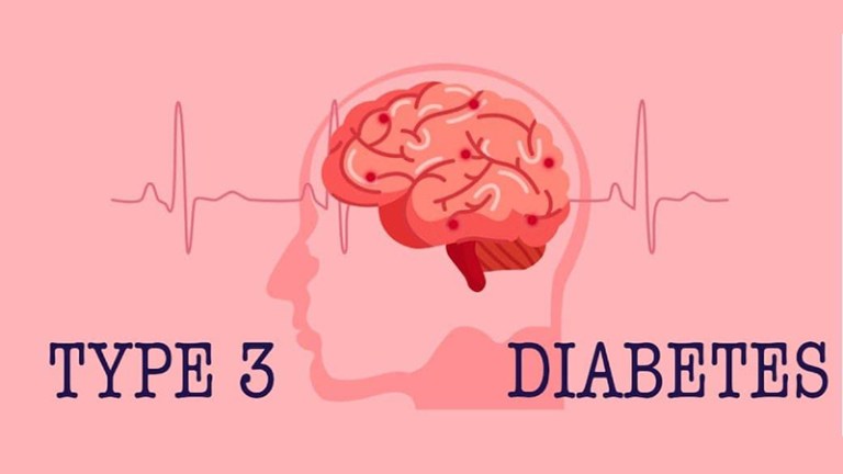 Type 3 Diabetes: What is it and Does it Exist?