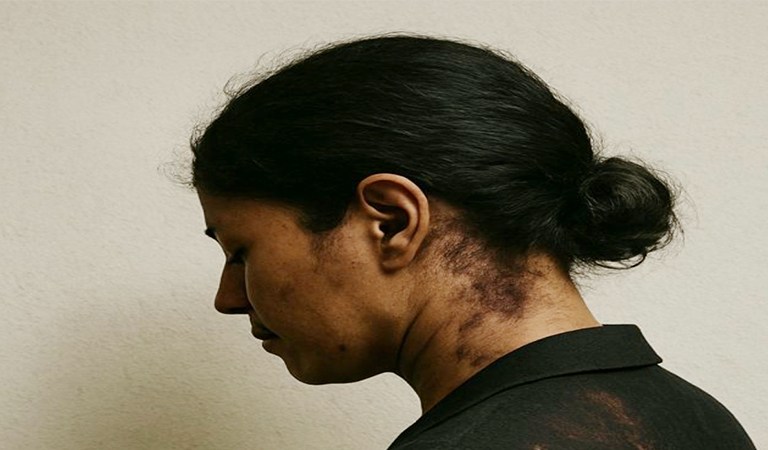 Resilience in the Shadows: How Sara Saleem Pursues Justice Amid Legal Uncertainty and Global Indifference
