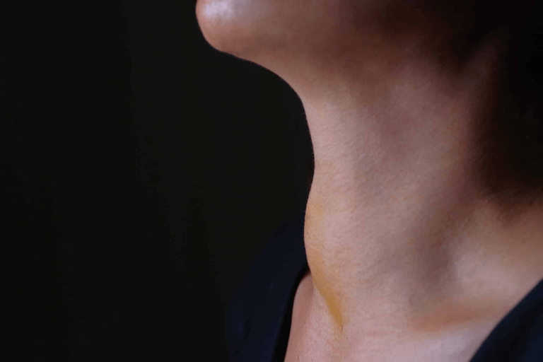 7 Overlooked Signs You Need Your Thyroid Checked