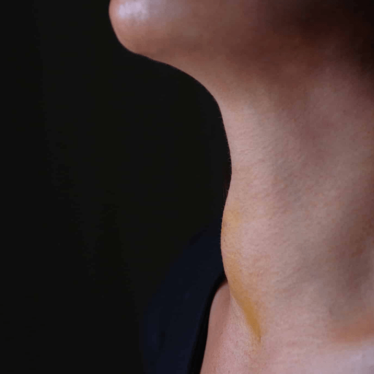 7 Overlooked Signs You Need Your Thyroid Checked