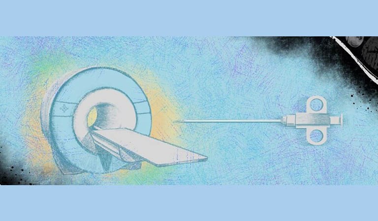 My Prostate Biopsy Story