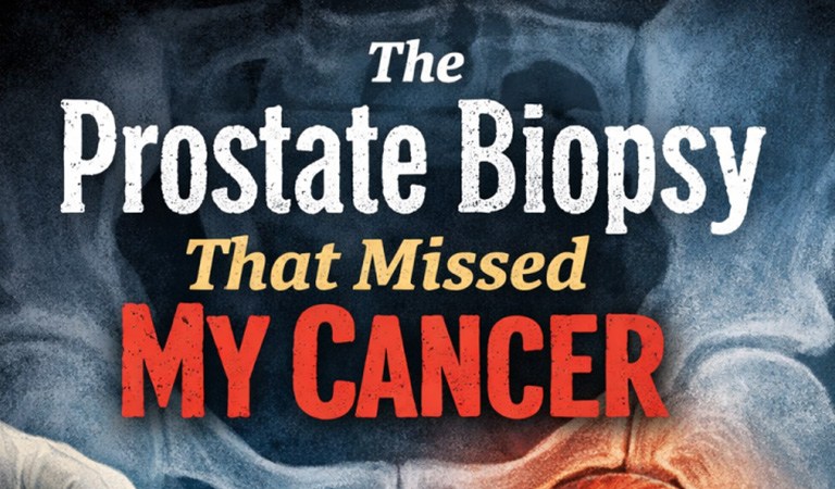 The Prostate Biopsy That Missed My Cancer