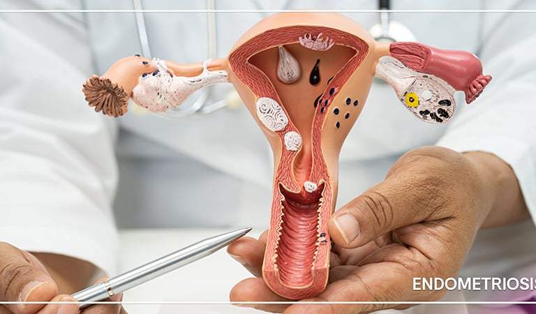 Celebrities Speak Out on Endometriosis, Shining a Spotlight on a Long-Overlooked Women’s Health Crisis