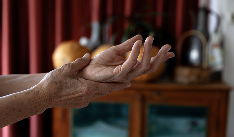 Psoriatic Arthritis Treatment: Expert Strategies for Managing Symptoms