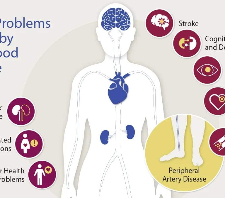 Understanding and Diagnosing High Blood Pressure