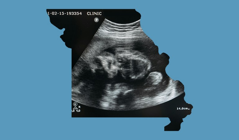 Missouri’s Born-Alive Bill, Gaming Sting, and Electoral Maps Drama: This Week Now in St. Louis and Missouri