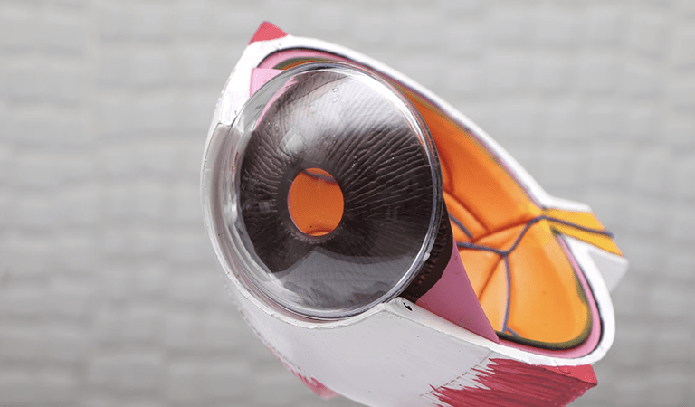 What Is Glaucoma? Causes, Symptoms, and Eye Treatments