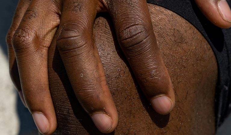 What Is Gout?