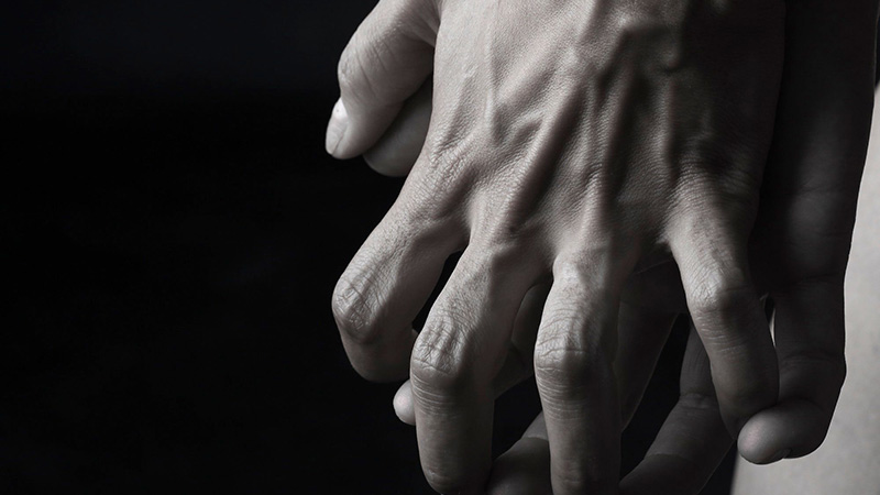 Arthritic Hands