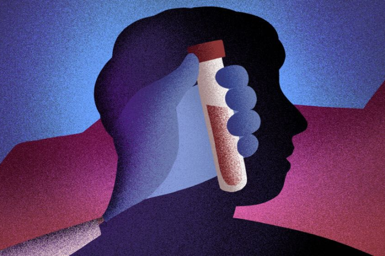 Understanding the PSA Test: Is It a Reliable Tool for Prostate Cancer Detection?