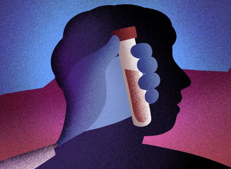 Understanding the PSA Test: Is It a Reliable Tool for Prostate Cancer Detection?