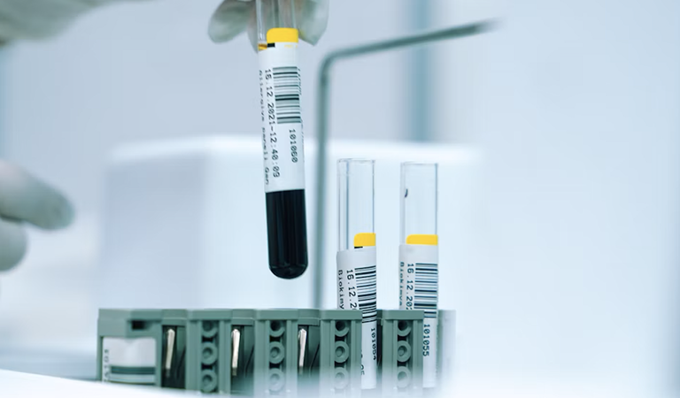 FDA Greenlights IsoPSA: The Blood Test Killing Useless Biopsies and Exposing True High-Grade Cancer