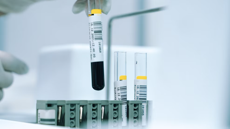 New Prostate Test